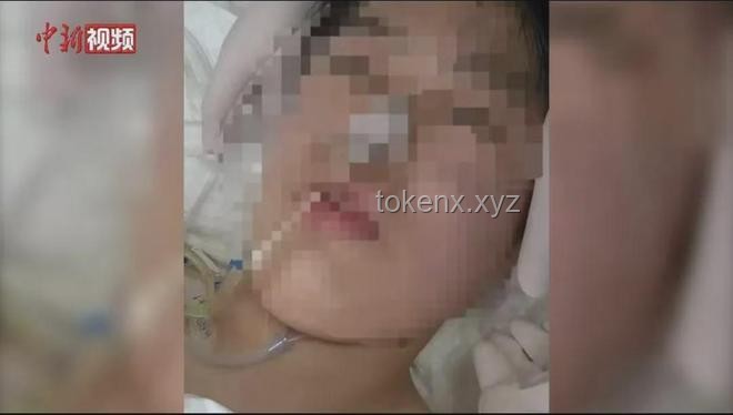 湖北17岁女孩脑死亡奇迹生还案例研究